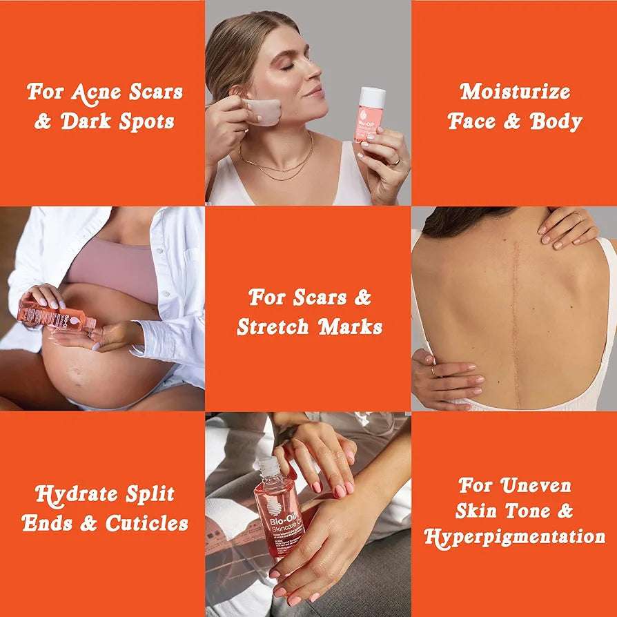 Bio-Oil Skincare Body Oil Serum for Scars and Stretch Marks, Body and Face Moisturizer, Dermatologist Recommended, Non-Comedogenic Pack of 3